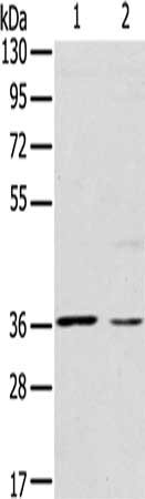 Gel: 8%SDS-PAGE, Lysate: 40 μg, Lane 1-2: Hepg2 cells, hela cells, Primary antibody: CERS1 Antibody(CERS1 Antibody) at dilution 1/200, Secondary antibody: Goat anti rabbit IgG at 1/8000 dilution, Exposure time: 20 secondsRabbit anti-Human CERS1 Polyclonal Antibody