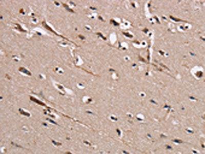 The image on the left is immunohistochemistry of paraffin-embedded Human brain  tissue using TRAFD1 Antibody(TRAFD1 Antibody) at dilution 1/20, on the right is treated with fusion protein. (Original magnification: ×200)Rabbit anti-Human TRAFD1 Polyclonal Antibody