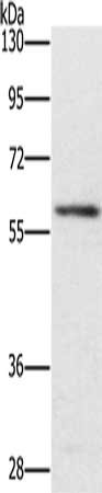 Gel: 8%SDS-PAGE, Lysate: 40 μg, Lane: Mouse spleen tissue, Primary antibody: TRAFD1 Antibody(TRAFD1 Antibody) at dilution 1/400, Secondary antibody: Goat anti rabbit IgG at 1/8000 dilution, Exposure time: 4 minutesRabbit anti-Human TRAFD1 Polyclonal Antibody