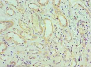Immunohistochemistry of paraffin-embedded human kidney tissue using SH3GLB1 Antibody at dilution of 1:100Rabbit anti-Human SH3GLB1 Polyclonal Antibody