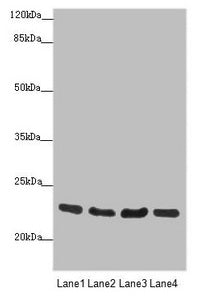 Western blot  | All lanes: RAB18 antibody at 0.88µg/ml  | Lane 1: HepG2 whole cell lysate  | Lane 2: PC-3 whole cell lysate  | Lane 3: A375 whole cell lysate  | Lane 4: 293T whole cell lysate  | Secondary  | Goat polyclonal to rabbit IgG at 1/10000 dilution  | Predicted band size: 23, 27, 16 kDa  | Observed band size: 23 kDaRabbit anti-Human RAB18 Polyclonal Antibody