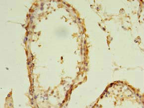 Immunohistochemistry of paraffin-embedded human testis tissue using EXOSC5 Antibody at dilution of 1:100Rabbit anti-Human EXOSC5 Polyclonal Antibody