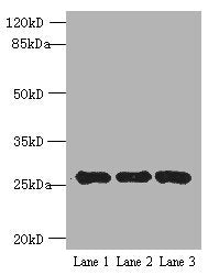 Western blot | All lanes: EXOSC5 antibody at 5μg/ml | Lane 1: K562 whole cell lysate | Lane 2: 293T whole cell lysate | Lane 3: Hela whole cell lysate | Secondary | Goat polyclonal to rabbit IgG at 1/10000 dilution | Predicted band size: 25 kDa | Observed band size: 25 kDaRabbit anti-Human EXOSC5 Polyclonal Antibody