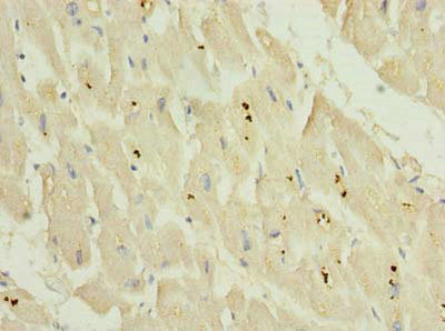 Immunohistochemistry of paraffin-embedded human heart tissue using KCNH7 Antibody at dilution of 1:100