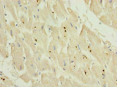 Immunohistochemistry of paraffin-embedded human heart tissue using KCNH7 Antibody at dilution of 1:100