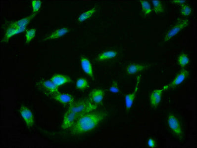 Immunofluorescence staining of Hela cells with NRBP2 Antibody at 1:133, counter-stained with DAPI. The cells were fixed in 4% formaldehyde, permeabilized using 0.2% Triton X-100 and blocked in 10% normal Goat Serum. The cells were then incubated with the antibody overnight at 4°C. The secondary antibody was Alexa Fluor 488-congugated AffiniPure Goat Anti-Rabbit IgG(H+L).