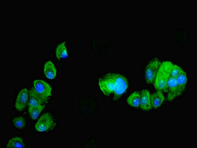 Immunofluorescent analysis of MCF-7 cells using PDRG1 Antibody at dilution of 1:100 and Alexa Fluor 488-congugated AffiniPure Goat Anti-Rabbit IgG(H+L)Rabbit anti-Human PDRG1 Polyclonal Antibody