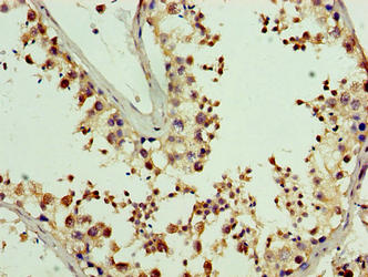 Immunohistochemistry of paraffin-embedded human testis tissue using PDRG1 Antibody at dilution of 1:100Rabbit anti-Human PDRG1 Polyclonal Antibody