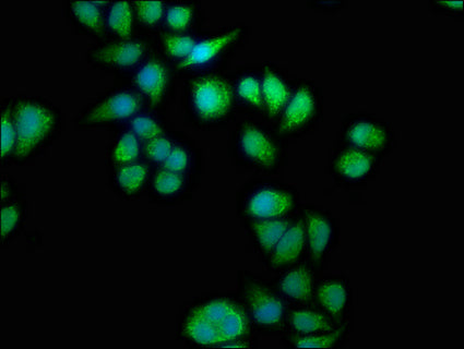 Immunofluorescence staining of Hela cells with SEPT11 Antibody at 1:133, counter-stained with DAPI. The cells were fixed in 4% formaldehyde, permeabilized using 0.2% Triton X-100 and blocked in 10% normal Goat Serum. The cells were then incubated with the antibody overnight at 4°C. The secondary antibody was Alexa Fluor 488-congugated AffiniPure Goat Anti-Rabbit IgG(H+L).Rabbit anti-Human SEPT11 Polyclonal Antibody