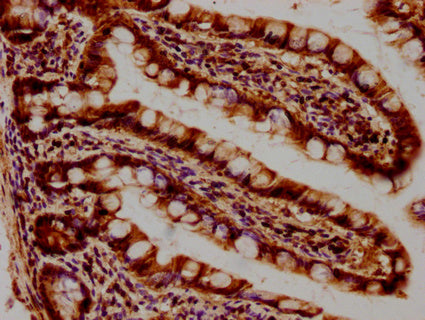 IHC image of SEPT11 Antibody diluted at 1:400 and staining in paraffin-embedded human small intestine tissue performed on a Leica BondTM system. After dewaxing and hydration, antigen retrieval was mediated by high pressure in a citrate buffer (pH 6.0). Section was blocked with 10% normal goat serum 30min at RT. Then primary antibody (1% BSA) was incubated at 4°C overnight. The primary is detected by a biotinylated secondary antibody and visualized using an HRP conjugated SP system.Rabbit anti-Human SEPT11 Polyclonal Antibody