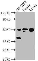 Western Blot | Positive WB detected in: SH-SY5Y whole cell lysate, Rat brain tissue, Rat liver tissue | All lanes: SEPT11 antibody at 1:2000 | Secondary | Goat polyclonal to rabbit IgG at 1/50000 dilution | Predicted band size: 50, 51 kDa | Observed band size: 50 kDaRabbit anti-Human SEPT11 Polyclonal Antibody