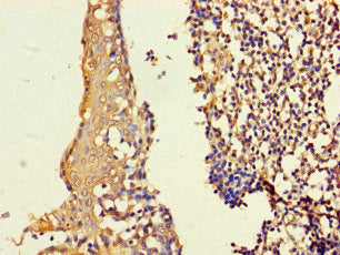 Immunohistochemistry of paraffin-embedded human tonsil tissue using ASF1B Antibody at dilution of 1:100Rabbit anti-Human ASF1B Polyclonal Antibody