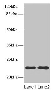 Western blot  | All lanes: ASF1B antibody at 13µg/ml  | Lane 1: MCF-7 whole cell lysate  | Lane 2: Jurkat whole cell lysate  | Secondary  | Goat polyclonal to rabbit IgG at 1/10000 dilution  | Predicted band size: 23 kDa  | Observed band size: 23 kDaRabbit anti-Human ASF1B Polyclonal Antibody