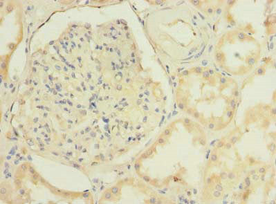 Immunohistochemistry of paraffin-embedded human kidney tissue using TMEM38B Antibody at dilution of 1:100Rabbit anti-Human TMEM38B Polyclonal Antibody