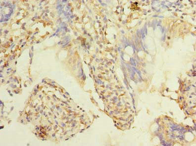 Immunohistochemistry of paraffin-embedded human small intestine tissue using TMEM38B Antibody at dilution of 1:100Rabbit anti-Human TMEM38B Polyclonal Antibody