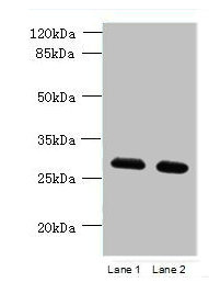 Western blot | All lanes: TMEM38B antibody at 1.5μg/ml | Lane 1: Mouse thymus tissue | Lane 2: Mouse liver tissue | Secondary | Goat polyclonal to rabbit IgG at 1/10000 dilution | Predicted band size: 33 kDa | Observed band size: 33 kDaRabbit anti-Human TMEM38B Polyclonal Antibody