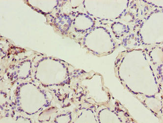 Immunohistochemistry of paraffin-embedded human thyroid tissue using the antibody at dilution of 1:100Rabbit anti-Human SLC52A1 Polyclonal Antibody