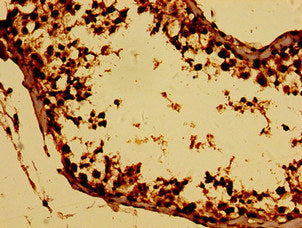 Immunohistochemistry of paraffin-embedded human testis tissue using BTG4 Antibody at dilution of 1:100
