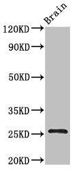 Western Blot | Positive WB detected in: Mouse brain tissue | All lanes: BTG4 antibody at 3μg/ml | Secondary | Goat polyclonal to rabbit IgG at 1/50000 dilution | Predicted band size: 26, 25 kDa | Observed band size: 26 kDa