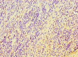 Immunohistochemistry of paraffin-embedded human tonsil tissue using TERF2IP Antibody at dilution of 1:100Rabbit anti-Human TERF2IP Polyclonal Antibody