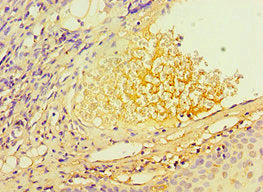 Immunohistochemistry of paraffin-embedded human blood plasma tissue using TERF2IP Antibody at dilution of 1:100Rabbit anti-Human TERF2IP Polyclonal Antibody