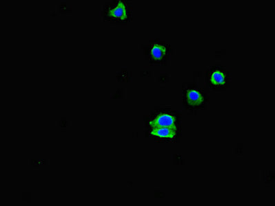 Immunofluorescent analysis of HepG2 cells using EHD3 Antibody at dilution of 1:100 and Alexa Fluor 488-congugated AffiniPure Goat Anti-Rabbit IgG(H+L)Rabbit anti-Human EHD3 Polyclonal Antibody