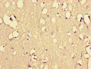 Immunohistochemistry of paraffin-embedded human brain tissue using the antibody at dilution of 1:100Rabbit anti-Human EHD3 Polyclonal Antibody