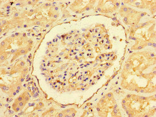 Immunohistochemistry of paraffin-embedded human kidney tissue using EHD3 Antibody at dilution of 1:100Rabbit anti-Human EHD3 Polyclonal Antibody