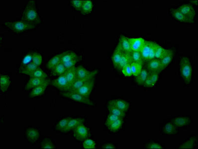 Immunofluorescence staining of HepG2 cells with CHMP5 Antibody at 1:266, counter-stained with DAPI. The cells were fixed in 4% formaldehyde, permeabilized using 0.2% Triton X-100 and blocked in 10% normal Goat Serum. The cells were then incubated with the antibody overnight at 4°C. The secondary antibody was Alexa Fluor 488-congugated AffiniPure Goat Anti-Rabbit IgG(H+L).
