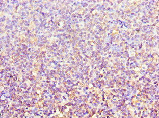 Immunohistochemistry of paraffin-embedded human tonsil tissue using ACTR3B Antibody at dilution of 1:100