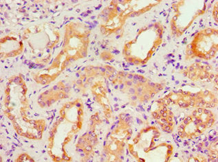 Immunohistochemistry of paraffin-embedded human kidney tissue using ACTR3B Antibody at dilution of 1:100