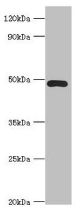 Western blot  | All lanes: ACTR3B antibody at 8µg/ml + HepG2 whole cell lysate  | Secondary  | Goat polyclonal to rabbit IgG at 1/10000 dilution  | Predicted band size: 48, 38, 40 kDa  | Observed band size: 48 kDa