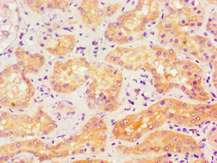 Immunohistochemistry of paraffin-embedded human kidney tissue using ACTR3B Antibody at dilution of 1:100Rabbit anti-Human ACTR3B Polyclonal Antibody