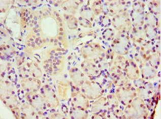 Immunohistochemistry of paraffin-embedded human pancreatic tissue using ACTR3B Antibody at dilution of 1:100Rabbit anti-Human ACTR3B Polyclonal Antibody