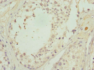 Immunohistochemistry of paraffin-embedded human testis tissue using CALCOCO1 Antibody at dilution of 1:100