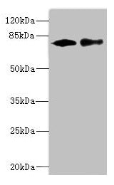 Western blot  | All lanes: CALCOCO1 antibody at 1.61µg/ml  | Lane 1: 293T whole cell lysate  | Lane 2: MCF-7 whole cell lysate  | Secondary  | Goat polyclonal to rabbit IgG at 1/10000 dilution  | Predicted band size: 78, 71, 68 kDa  | Observed band size: 78 kDa