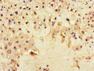 Immunohistochemistry of paraffin-embedded human placenta tissue using DNAH1 Antibody at dilution of 1:100Rabbit anti-Human DNAH1 Polyclonal Antibody