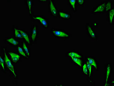 Immunofluorescent analysis of Hela cells using MAP10 Antibody at dilution of 1:100 and Alexa Fluor 488-congugated AffiniPure Goat Anti-Rabbit IgG(H+L)
