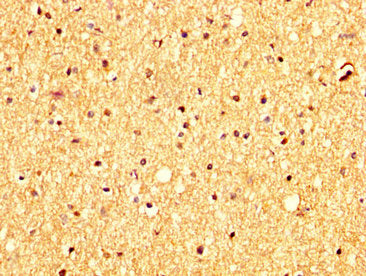 IHC image of RHCG Antibody diluted at 1:300 and staining in paraffin-embedded human brain tissue performed on a Leica BondTM system. After dewaxing and hydration, antigen retrieval was mediated by high pressure in a citrate buffer (pH 6.0). Section was blocked with 10% normal goat serum 30min at RT. Then primary antibody (1% BSA) was incubated at 4°C overnight. The primary is detected by a biotinylated secondary antibody and visualized using an HRP conjugated SP system.Rabbit anti-Human RHCG Polyclonal Antibody