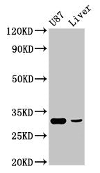 Western Blot  | Positive WB detected in: U87 whole cell lysate, Rat liver tissue  | All lanes: ITM2B antibody at 4.9μg/ml  | Secondary  | Goat polyclonal to rabbit IgG at 1/50000 dilution  | Predicted band size: 54 kDa  | Observed band size: 31 kDaRabbit anti-Human RHCG Polyclonal Antibody