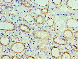 Immunohistochemistry of paraffin-embedded human kidney tissue using COPS7A Antibody at dilution of 1:100Rabbit anti-Human COPS7A Polyclonal Antibody