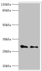 Western blot | All lanes: COP9 signalosome complex subunit 7a antibody at 4μg/ml | Lane 1: Rat heart tissue | Lane 2: Rat brain tissue | Secondary | Goat polyclonal to rabbit IgG at 1/10000 dilution | Predicted band size: 30 kDa | Observed band size: 30 kDaRabbit anti-Human COPS7A Polyclonal Antibody