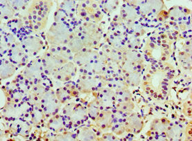 Immunohistochemistry of paraffin-embedded human pancreatic tissue using COPS7A Antibody at dilution of 1:100Rabbit anti-Human COPS7A Polyclonal Antibody