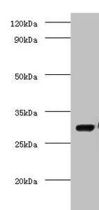 Western blot | All lanes: COP9 signalosome complex subunit 7a antibody at 2μg/ml + Mouse brain tissue | Secondary | Goat polyclonal to rabbit IgG at 1/10000 dilution | Predicted band size: 30 kDa | Observed band size: 30 kDaRabbit anti-Human COPS7A Polyclonal Antibody