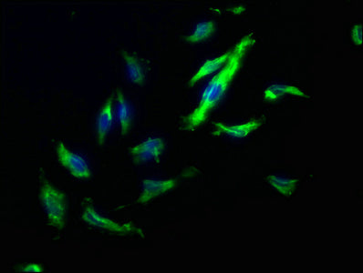 Immunofluorescence staining of U251 cells with TJP2 Antibody at 1:200, counter-stained with DAPI. The cells were fixed in 4% formaldehyde, permeabilized using 0.2% Triton X-100 and blocked in 10% normal Goat Serum. The cells were then incubated with the antibody overnight at 4°C. The secondary antibody was Alexa Fluor 488-congugated AffiniPure Goat Anti-Rabbit IgG(H+L).Rabbit anti-Human TJP2 Polyclonal Antibody