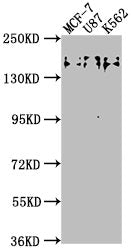 Western Blot | Positive WB detected in: MCF-7 whole cell lysate, U87 whole cell lysate, K562 whole cell lysate | All lanes: TJP2 antibody at 1:2000 | Secondary | Goat polyclonal to rabbit IgG at 1/50000 dilution | Predicted band size: 134, 118, 112, 132, 116, 131, 138 kDa | Observed band size: 150 kDaRabbit anti-Human TJP2 Polyclonal Antibody