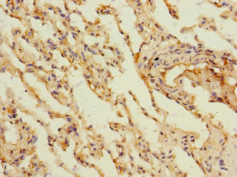 Immunohistochemistry of paraffin-embedded human lung tissue using MARCO Antibody at dilution of 1:100Rabbit anti-Human MARCO Polyclonal Antibody
