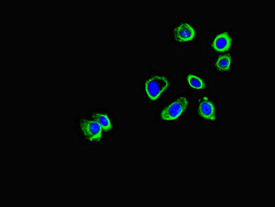 Immunofluorescent analysis of HepG2 cells using CORO1B Antibody at dilution of 1:100 and Alexa Fluor 488-congugated AffiniPure Goat Anti-Rabbit IgG(H+L)Rabbit anti-Human CORO1B Polyclonal Antibody