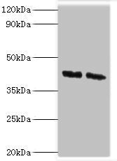 Western blot | All lanes: COPS4 antibody at 8μg/ml | Lane 1: Hela whole cell lysate | Lane 2: HepG2 whole cell lysate | Secondary | Goat polyclonal to rabbit IgG at 1/10000 dilution | Predicted band size: 47, 41 kDa | Observed band size: 47 kDaRabbit anti-Human COPS4 Polyclonal Antibody