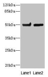 Western blot | All lanes: TUBB6 antibody at 4μg/ml | Lane 1: Hela whole cell lysate | Lane 2: MDA-MB-231 whole cell lysate | Secondary | Goat polyclonal to rabbit IgG at 1/10000 dilution | Predicted band size: 50 kDa | Observed band size: 50 kDaRabbit anti-Human TUBB6 Polyclonal Antibody